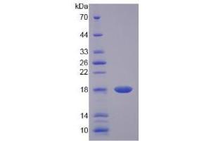 SDS-PAGE analysis of Rat IL17 Protein.