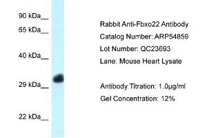 Western Blotting (WB) image for anti-F-Box Protein 22 (FBXO22) (Middle Region) antibody (ABIN2785926) (FBXO22 抗体  (Middle Region))
