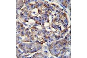 Immunohistochemistry (Paraffin-embedded Sections) (IHC (p)) image for anti-Protein Phosphatase 1, Regulatory Subunit 37 (PPP1R37) (AA 43-71), (N-Term) antibody (ABIN953233)