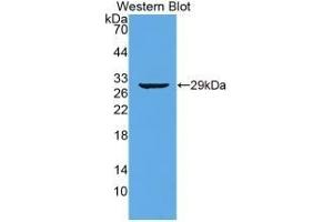 Detection of Recombinant TTN, Human using Monoclonal Antibody to Titin (TTN) (Titin 抗体  (AA 33779-34025))