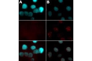 Histone H2AX phospho Ser139 antibody tested by immunofluorescence. (H2AFX 抗体  (pSer139))