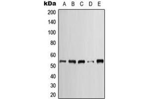 Western blot analysis of Cytokeratin 7 expression in HeLa (A), SP2/0 (B), H9C2 (C), A431 (D), NIH3T3 (E) whole cell lysates. (Cytokeratin 7 抗体  (C-Term))