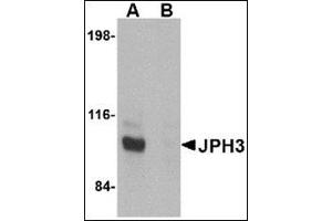 Western blot analysis of JPH3 in Daudi cell lysate with this product at 1 μg/ml in (A) the absence and (B) the presence of blocking peptide. (Junctophilin 3 抗体  (C-Term))