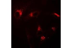 Immunofluorescent analysis of USP10 staining in A549 cells. (USP10 抗体)