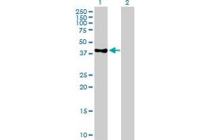 Western Blot analysis of POLE expression in transfected 293T cell line by POLE MaxPab polyclonal antibody. (POLE 抗体  (AA 1-370))
