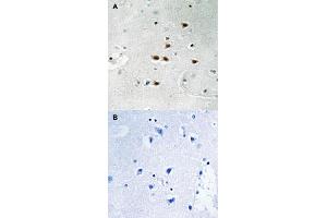 Immunohistochemical staining of human brain tissue by ITCH (phospho Y420) polyclonal antibody  without blocking peptide (A) or preincubated with blocking peptide (B) under 1:50-1:100 dilution. (ITCH 抗体  (pTyr420))