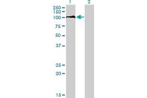 Western Blot analysis of DDX54 expression in transfected 293T cell line by DDX54 monoclonal antibody (M01), clone 2H6. (DDX54 抗体  (AA 778-881))