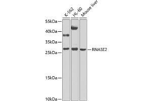 Western blot analysis of extracts of various cell lines, using RN antibody (ABIN6131626, ABIN6146986, ABIN6146987 and ABIN6225283) at 1:1000 dilution. (RNASE2 抗体  (AA 28-161))
