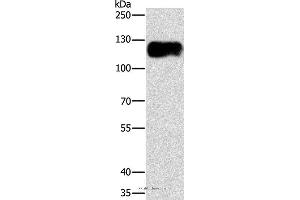 Western blot analysis of Lovo cell, using CAST Polyclonal Antibody at dilution of 1:750 (Calpastatin 抗体)