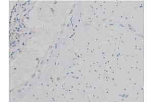 ABIN6267390 at 1/200 staining Human esophagus tissue sections by IHC-P. (ATF2 抗体  (pThr53, pThr71))