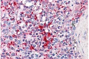 Human Spleen: Formalin-Fixed, Paraffin-Embedded (FFPE) (TLN1 抗体  (AA 1052-1150))