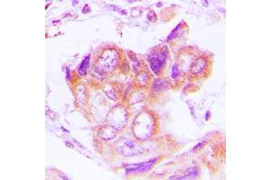 Immunohistochemistry (IHC) image for anti-Proteasome (Prosome, Macropain) 26S Subunit, Non-ATPase, 2 (PSMD2) (N-Term) antibody (ABIN7296738)