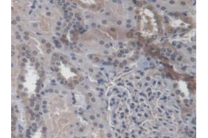 Detection of RAB37 in Human Kidney Tissue using Polyclonal Antibody to RAB37, Member RAS Oncogene Family (RAB37) (RAB37 抗体  (AA 19-220))
