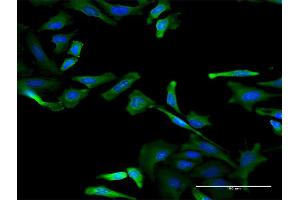 Immunofluorescence of monoclonal antibody to RBM3 on HeLa cell.