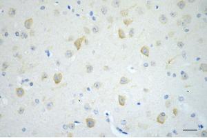 Immunohistochemistry was performed on paraffin-embedded mouse brain using CD19 antibody (ABIN7797954), 1:200). (Recombinant CD19 抗体)