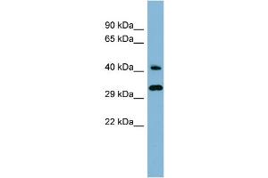 Western Blotting (WB) image for anti-DnaJ (Hsp40) Homolog, Subfamily C, Member 27 (DNAJC27) (Middle Region) antibody (ABIN2786982)