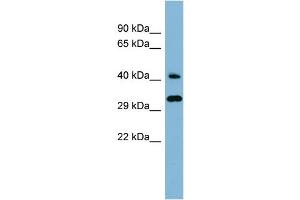 WB Suggested Anti-RBJ Antibody Titration: 0. (DNAJC27 抗体  (Middle Region))