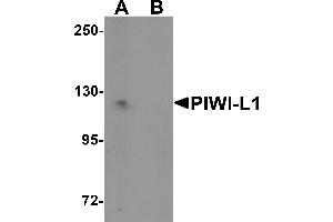 Western Blotting (WB) image for anti-Piwi-Like 1 (PIWIL1) (N-Term) antibody (ABIN1031515) (PIWIL1 抗体  (N-Term))