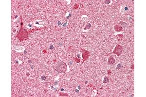 Anti-DOC2A antibody IHC staining of human brain, cortex. (DOC2A 抗体  (AA 233-246))