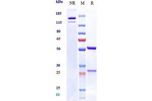 Anti-OSMR Reference Antibody (vixarelimab) on SDS-PAGE under reducing (R) condition. (Recombinant OSMR (Vixarelimab Biosimilar) 抗体)