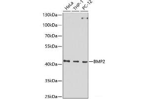 Western blot analysis of extracts of various cell lines using BMP2 Polyclonal Antibody at dilution of 1:1000. (BMP2 抗体)