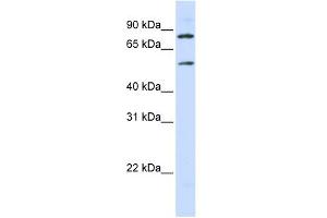 Western Blotting (WB) image for anti-Solute Carrier Family 27 (Fatty Acid Transporter), Member 4 (SLC27A4) (Middle Region) antibody (ABIN2781620)