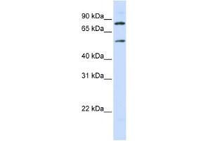 WB Suggested Anti-SLC27A4 Antibody Titration:  0.
