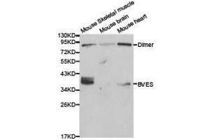 Western Blotting (WB) image for anti-Blood Vessel Epicardial Substance (BVES) antibody (ABIN1871374) (BVES 抗体)