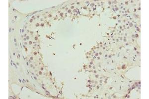 Immunohistochemistry of paraffin-embedded human testis tissue using ABIN7155453 at dilution of 1:100 (Retinoblastoma Binding Protein 4 抗体  (AA 246-425))