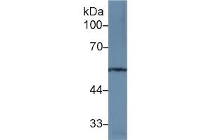 Detection of MMP12 in Rat Spinal cord lysate using Polyclonal Antibody to Matrix Metalloproteinase 12 (MMP12) (MMP12 抗体  (AA 100-286))