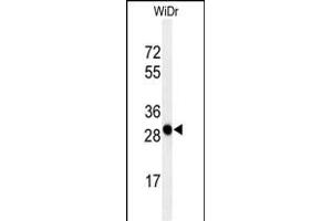 Western blot analysis of QR3 Antibody (C-term) (ABIN650916 and ABIN2839993) in WiDr cell line lysates (35 μg/lane). (PAQR3 抗体  (C-Term))