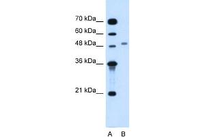 WB Suggested Anti-MGAT2 Antibody Titration:  1. (MGAT2 抗体  (Middle Region))