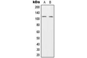 Western blot analysis of HGS expression in H1299 (A), HeLa (B) whole cell lysates. (HGS 抗体  (Center))