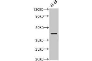 Western Blot Positive WB detected in: A549 whole cell lysate All lanes: NDRG4 antibody at 2 μg/mL Secondary Goat polyclonal to rabbit IgG at 1/50000 dilution Predicted band size: 39, 38, 41, 43, 40 kDa Observed band size: 43 kDa (NDRG4 抗体  (AA 210-331))