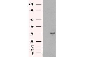 HEK293 overexpressing DOK5 (ABIN5345413) and probed with ABIN185292 (mock transfection in first lane). (DOK5 抗体  (C-Term))