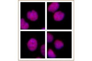 MMSET / WHSC1 antibody (mAb) tested by immunofluorescence. (WHSC1 抗体  (AA 1-647))