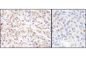Immunohistochemistry (IHC) image for anti-SIN3 homolog A, transcription regulator (SIN3A) (AA 1-50) antibody (ABIN7453786)