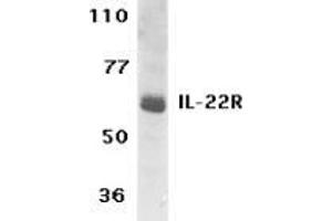 Western blot analysis of IL-22 Receptor expression in human HepG2 cell lysate with AP30416PU-N IL-22 Receptor antibody at 1 μg /ml. (IL22 Receptor alpha 1 抗体  (C-Term))