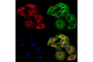 ABIN6263421 and ABIN6273057 staining Hela cells by IF/ICC. (MTHFD2 抗体  (N-Term))