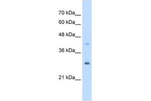 Western Blotting (WB) image for anti-Calcyclin Binding Protein (CACYBP) antibody (ABIN2463420) (CACYBP 抗体)