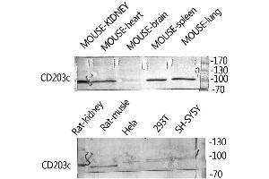Western Blot (WB) analysis of Rat Kidney HeLa 293T SH-SY5Y Mouse Kidney, Mouse Spleen, Mouse Lung, using ENPP3 Polyclonal Antibody. (ENPP3 抗体  (Internal Region))