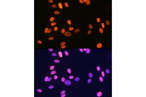 Immunofluorescence analysis of U-2 OS cells using Histone H1. (HIST1H1C 抗体)