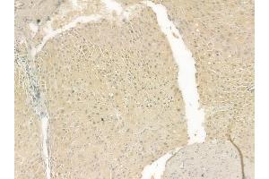 ABIN6262191 and ABIN6269396 at 1/100 staining human normal liver tissue by IHC-P. (HDAC8 抗体  (N-Term))