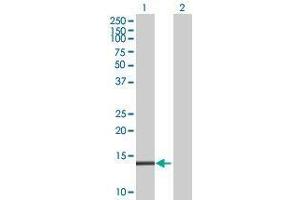 Lane 1: TMEM42 transfected lysate ( 17 KDa) Lane 2: Non-transfected lysate. (TMEM42 293T Cell Transient Overexpression Lysate(Denatured))