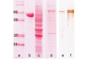 Western Blotting (WB) image for anti-Myxovirus Resistance Protein 1 (MX1) antibody (ABIN781793) (MX1 抗体)