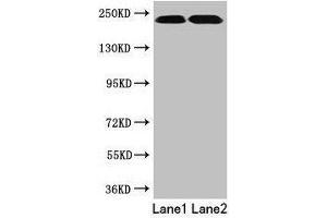 Western blot All lanes: TLN2 antibody at 12 μg/mL Lane 1: Hela whole cell lysate Lane 2: Jurkat whole cell lysate Secondary Goat polyclonal to rabbit IgG at 1/10000 dilution Predicted band size: 272 kDa Observed band size: 230 kDa (TLN2 抗体  (AA 88-406))