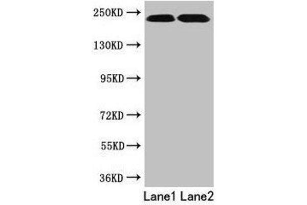 TLN2 抗体  (AA 88-406)