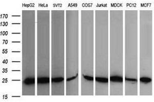 Image no. 4 for anti-V-Ral Simian Leukemia Viral Oncogene Homolog B (Ras Related, GTP Binding Protein) (Ralb) antibody (ABIN1500584)