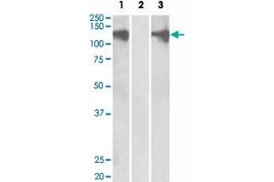 HEK293 lysate (10 ug protein in RIPA buffer) overexpressing human PUM2 with DYKDDDDK tag probed with PUM2 polyclonal antibody  (0. (PUM2 抗体  (Internal Region))