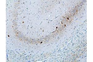 IHC analysis of MTR using anti-MTR antibody (ABIN7602599).